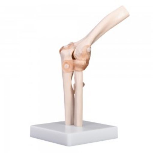 Picture of Model, Human Elbow Joint Model